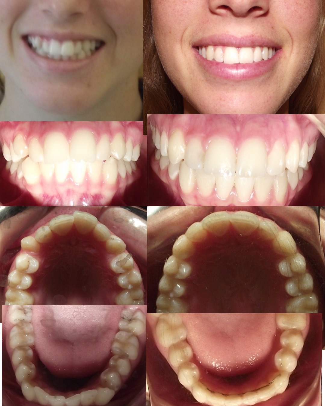 Transformación dental 12