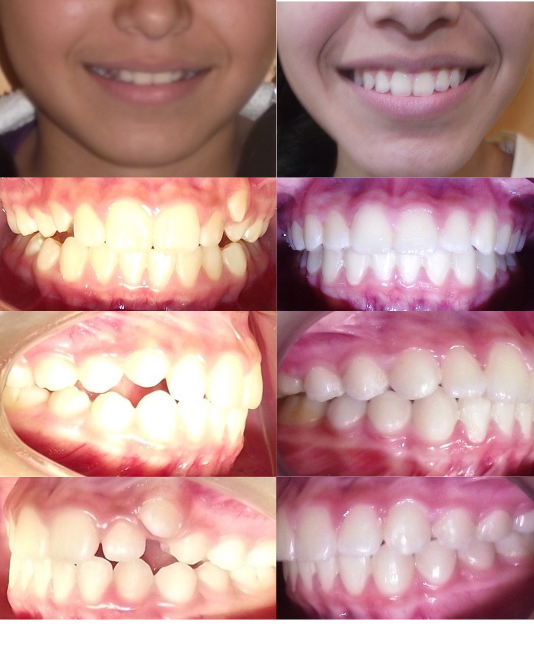 Transformación dental 2