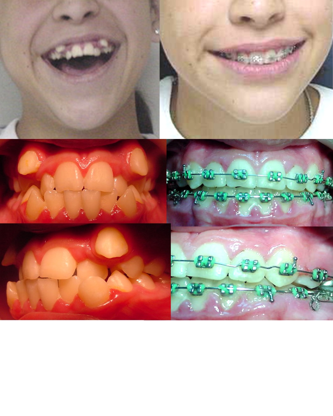 Transformación dental 7