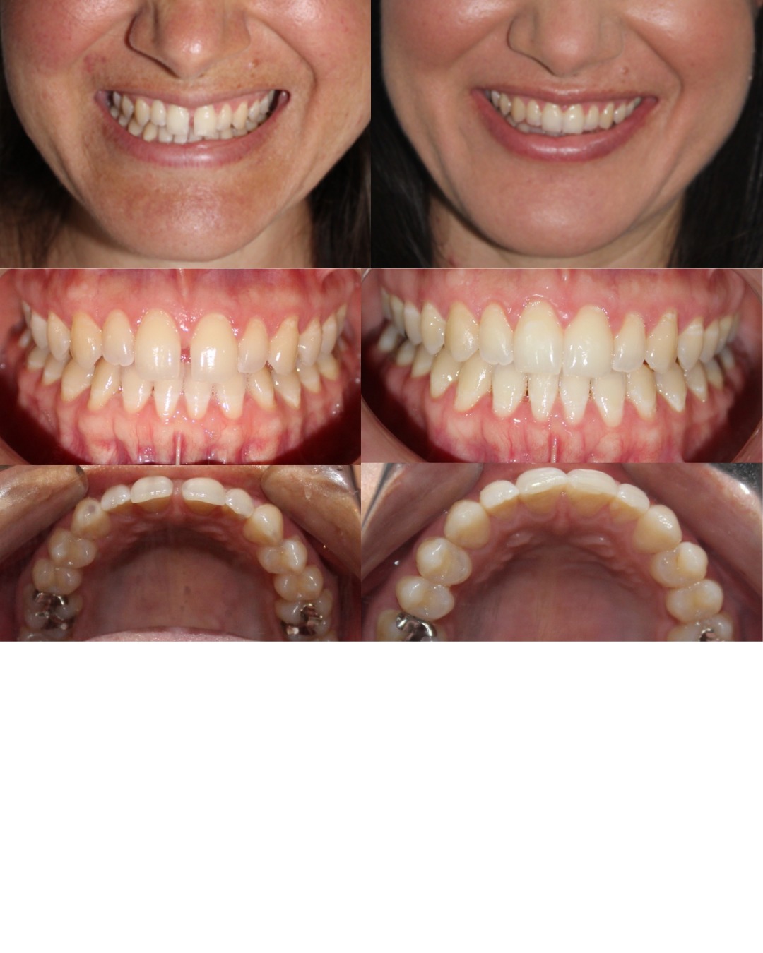 Transformación dental 9